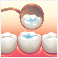 New Project – 2022-09-23T105529.325